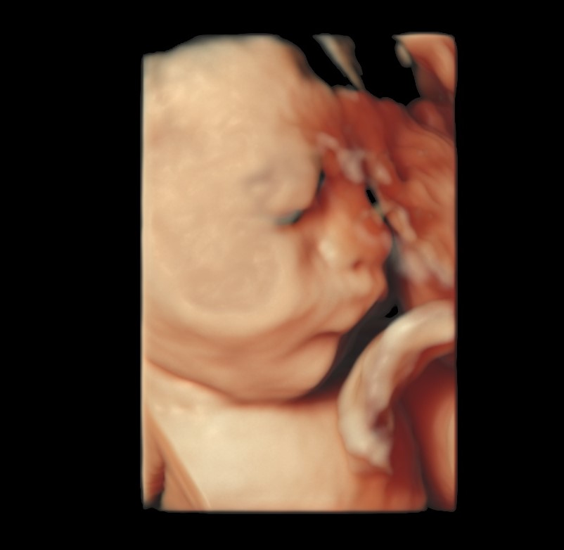 Standard ultrasound image